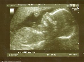 20 неделек, мой мальчик)