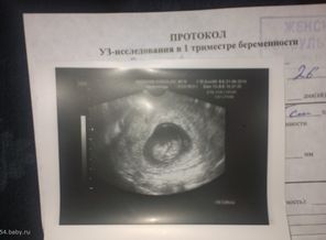 Ангелина 10 недель