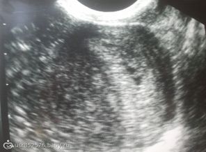 2014-02-11 22.11.32