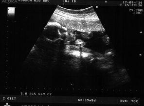 Наше первое фото