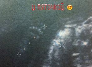 18 недель