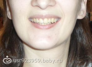 новые зубы 31 10 2014
