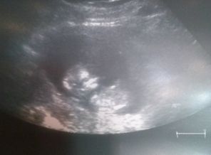 CAM01213