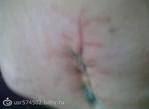 57700621.p.500.500.0