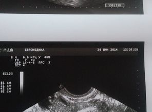 мои первые слова:" вот и наше маленькое яичко" узист смеялась))))