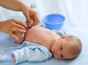 krovotochit-pupok-u-novorozhdennogo
