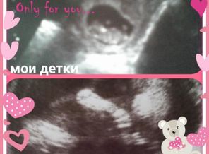 2014-12-06_18.26.59