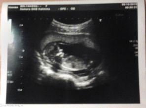 Первое фото малышки) 13 недель