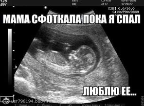 X28fcMN1isA